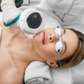Facial Spa LA on IPL Treatment