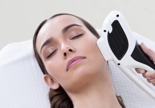 IPL Treatment Schedule: How to Achieve Optimal Results